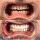 Slider image (10) Luna Dental Clinic